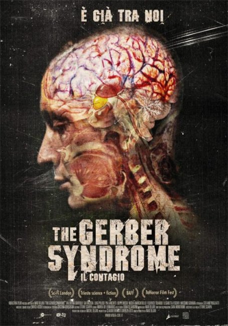 Синдром Гербера / The Gerber Syndrome: il contagio (2011) - Трейлеры