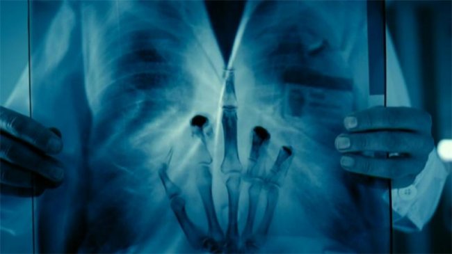 Интерны 2 сезон - Трейлеры